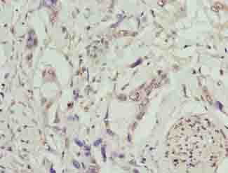 Polyclonal Rabbit anti-Human TMEM53 Antibody (IHC, WB)