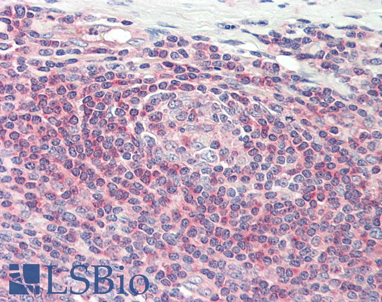 IHC-plus™ ARHGEF18 Antibody
