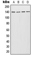 Polyclonal Rabbit anti-Human INCENP Antibody (Internal, WB)