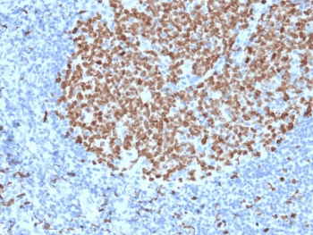 MKI67 / Ki67 Antibody (clone MKI67/2463)