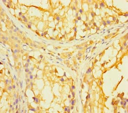 Polyclonal Rabbit anti-Human PAGE2B Antibody