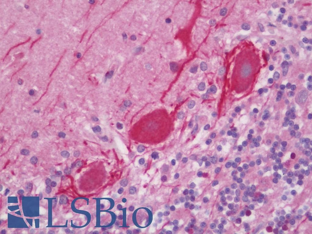 IHC-plus™ NF-L / NEFL Antibody (aa295-344)