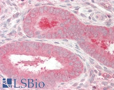 IHC-plus™ Polyclonal Rabbit anti-Human COMP / THBS5 Antibody (IHC, IF, WB)