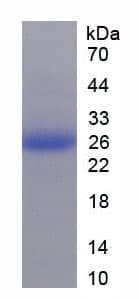 Rat FBN1 / Fibrillin 1 Protein (Recombinant 6His, N-terminus)