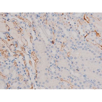 CDC25A Antibody (phospho-Ser75)