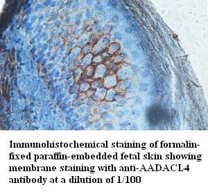 AADACL4 Antibody