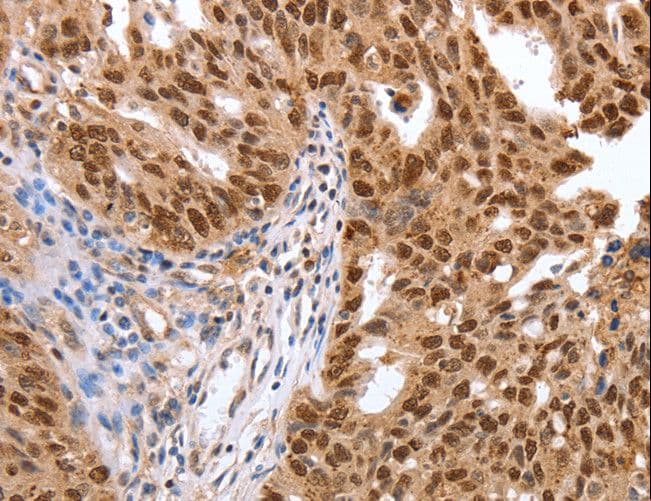 PARP1 Antibody