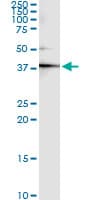 CKM / Creatine Kinase MM Antibody (clone 3E1-F3)