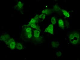 PME-1 / PPME1 Antibody (clone OTI4A12)