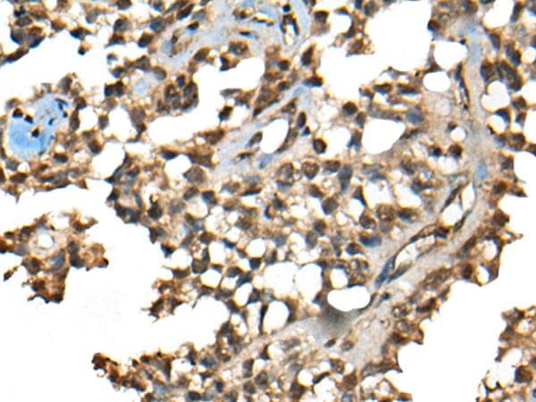 CCDC12 Antibody
