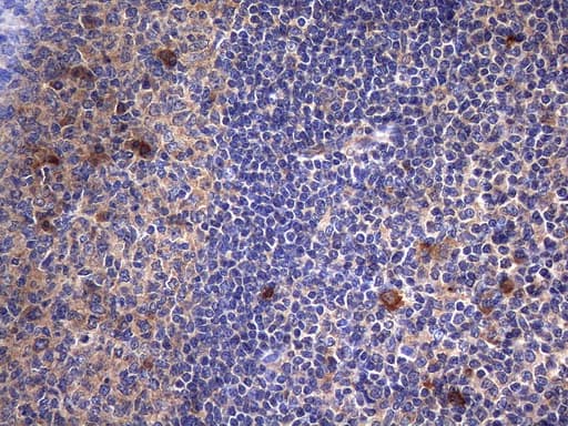 Complement C2 Antibody (aa469-752, clone OTI12G10)