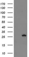 FXN / Frataxin Antibody (clone OTI3C7)