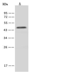 Polyclonal Rabbit anti-Human ZNF766 Antibody (IHC, WB)