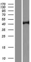 TRDMT1 / DNMT2 Protein (Over-Expression Lysate Myc-DDK (Flag))