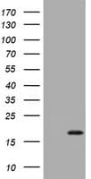 p16INK4a / CDKN2A Antibody (aa25-156, clone OTI1F6)