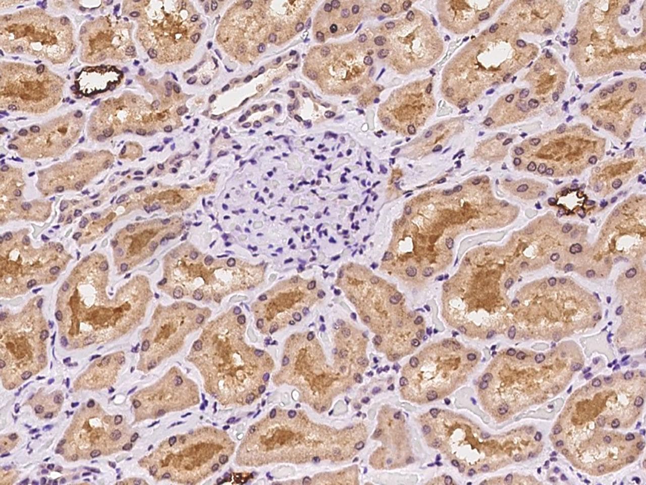 DDX39 Antibody