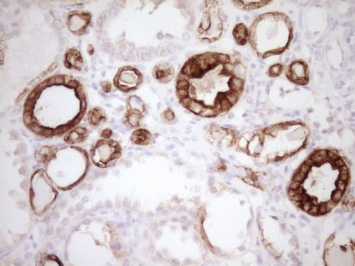 Monoclonal Mouse anti-Human KRT19 / CK19 / Cytokeratin 19 Antibody (clone OTI6A8, aa240-390, IHC, WB)
