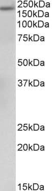 IHC-plus™ A2M / Alpha-2-Macroglobulin Antibody (aa417-430)