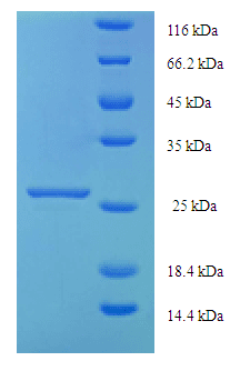 Human KIAA1377 Protein (Recombinant His-SUMO)