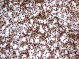 Monoclonal Mouse anti-Human Vimentin Antibody (clone OTI5D7, IHC, WB)