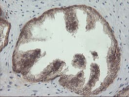 Monoclonal Mouse anti-Human PIK3CG / PI3K Gamma Antibody (clone OTI2B1, IHC, WB)
