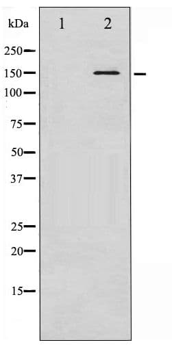 CML / BCR Antibody (phospho-Tyr360)