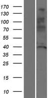Human SSUH2 / C3orf32 Protein (Over-Expression Lysate Myc-DDK (Flag))