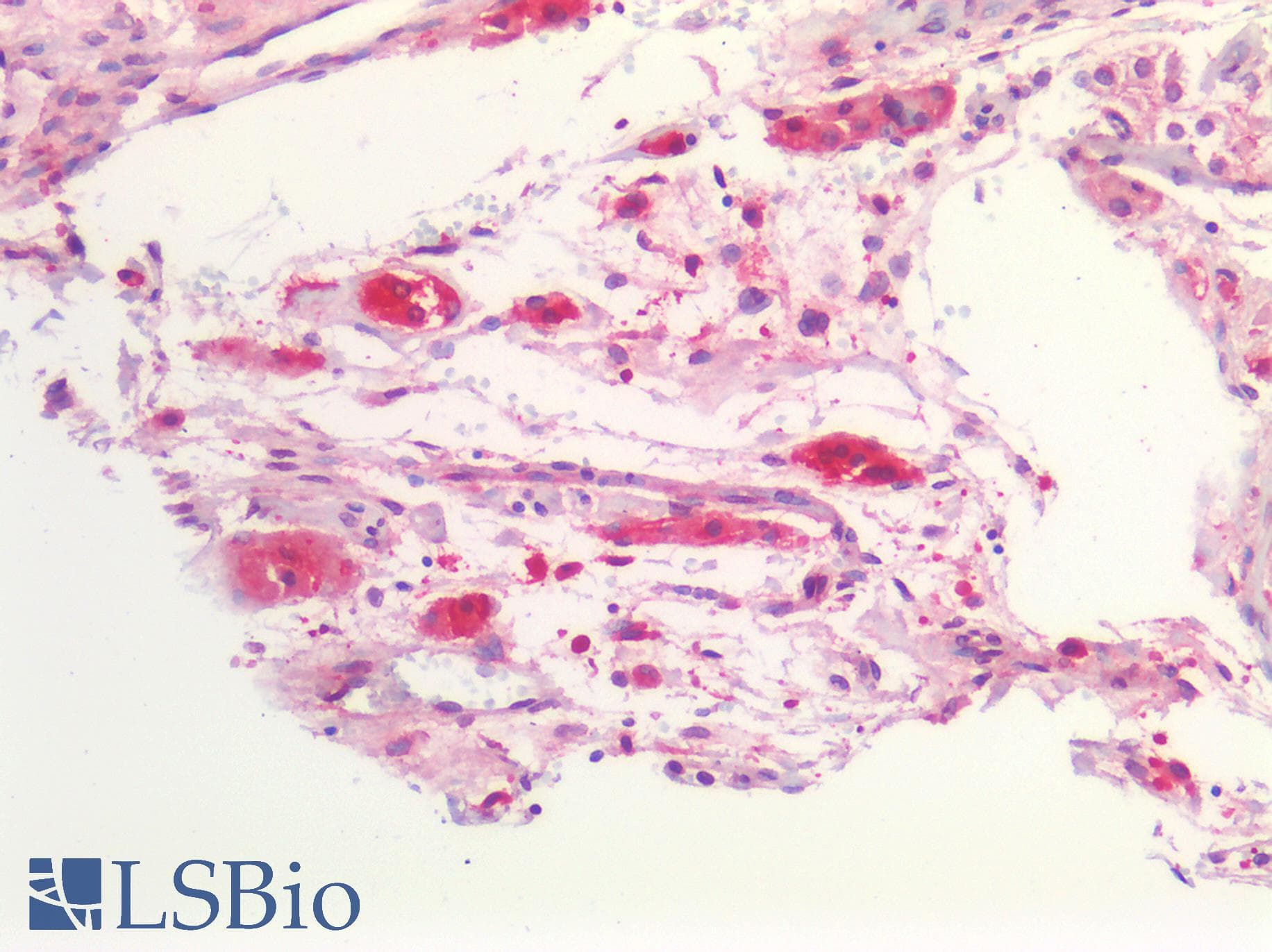 PathPlus™ Polyclonal Rabbit anti-Human GLUL / Glutamine Synthetase Antibody (IHC)