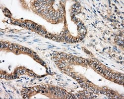 BTK Antibody (clone OTI3A2)