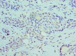 SLURP1 / ARS / MDM Antibody (aa1-103)