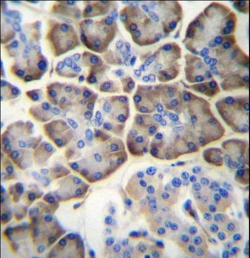 KCNV2 / Kv11.1 Antibody (aa478-507)