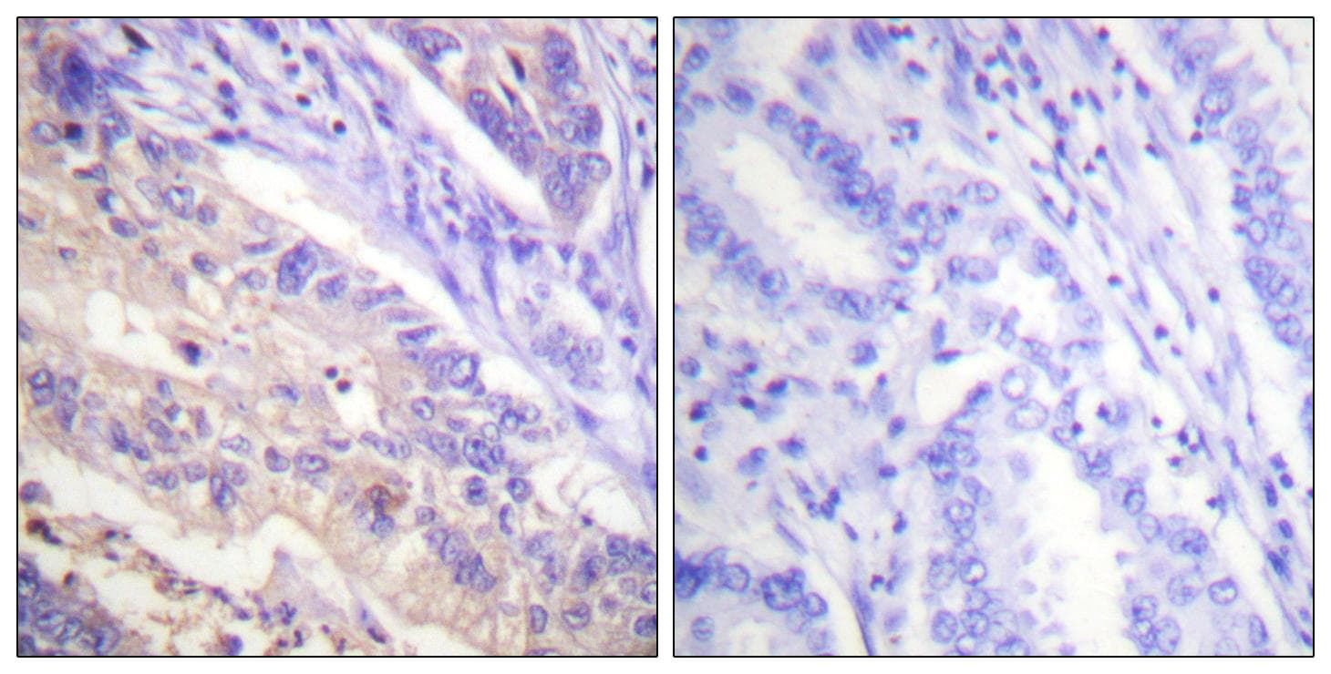PTEN Antibody (phospho-Ser385)