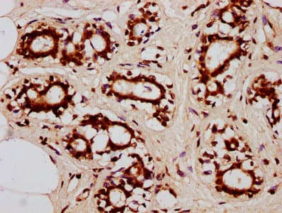 HIST1H2BN Antibody