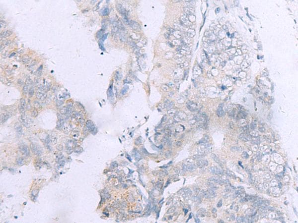 GPC3 / Glypican 3 Antibody