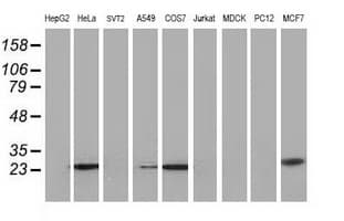 AK4 / Adenylate Kinase 4 Antibody (clone OTI3E1)