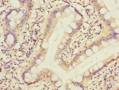 PPM1D / WIP1 Antibody