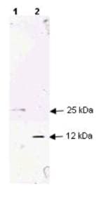 PathPlus™ Polyclonal Rabbit anti-Human TGFB1 / TGF Beta 1 Antibody (IHC, IF, WB)