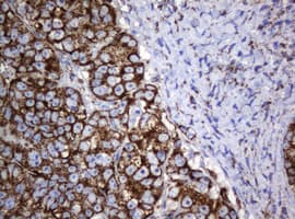 HSPD1 / HSP60 Antibody (clone OTI6F7)