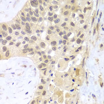 Polyclonal Rabbit anti-Human PSMC5 / SUG1 Antibody (IHC, IF, WB)
