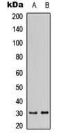 Polyclonal Rabbit anti-Human DHRS11 / MGC4172 Antibody (Internal, WB)