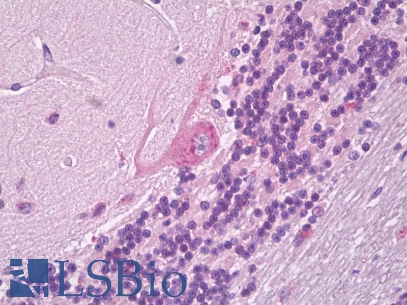 IHC-plus™ MTDH / Metadherin Antibody (N-Terminus)