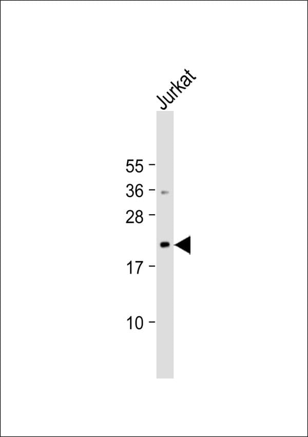 Polyclonal Rabbit anti-Human CD58 Antibody (WB)