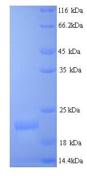 Chicken Collagen XII Alpha 1 Protein (Recombinant His)