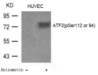 Polyclonal Rabbit anti-Human ATF2 Antibody (IHC, WB)