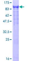 Human ZSCAN18 / ZNF447 Protein (Recombinant GST)