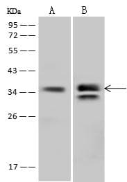 MRPL3 Antibody