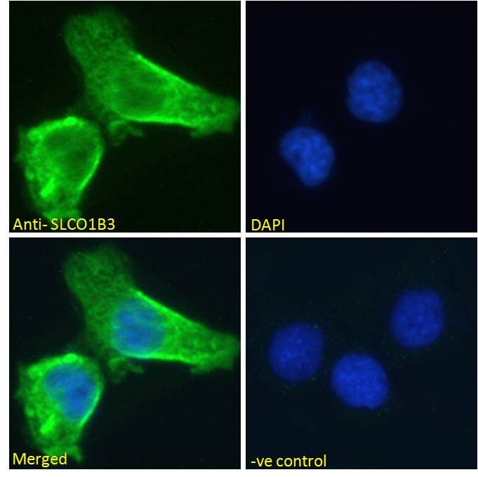 SLCO1B3 / OATP8 Antibody (aa151-161)