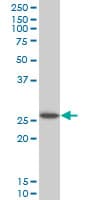HOXC12 Antibody (clone 1C6)