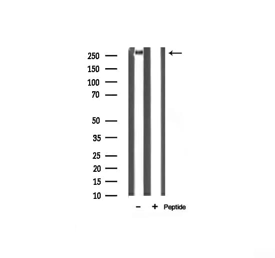 Polyclonal Rabbit anti-Human FLNA / Filamin A Antibody (IHC, IF, WB)