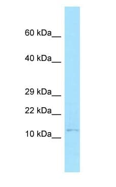 BANF1 / BAF / BCRP1 Antibody (C-Terminus)